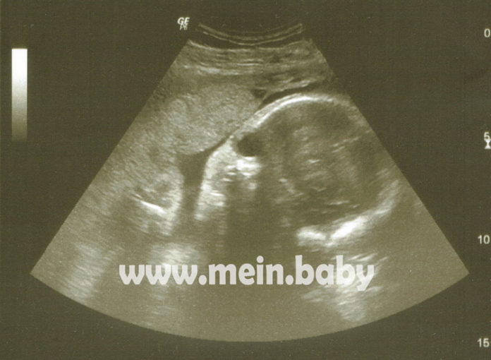 Mein-Baby-Ultraschallbild-29-ssw-2