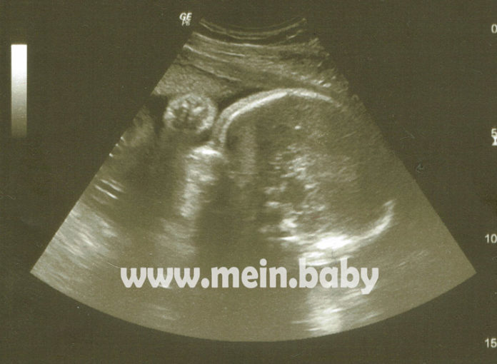 Mein-Baby-Ultraschallbild-29-ssw